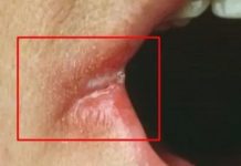 OPASNO PO ŽIVOT: Imate li neki od OVIH simptoma? Nagovještavaju nešto loše! OPASNO PO ŽIVOT: Imate li neki od OVIH simptoma? Nagovještavaju nešto loše! - featured image