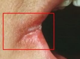OPASNO PO ŽIVOT: Imate li neki od OVIH simptoma? Nagovještavaju nešto loše! OPASNO PO ŽIVOT: Imate li neki od OVIH simptoma? Nagovještavaju nešto loše! - featured image
