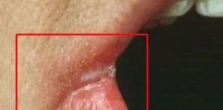 OPASNO PO ŽIVOT: Imate li neki od OVIH simptoma? Nagovještavaju nešto loše! OPASNO PO ŽIVOT: Imate li neki od OVIH simptoma? Nagovještavaju nešto loše! - featured image