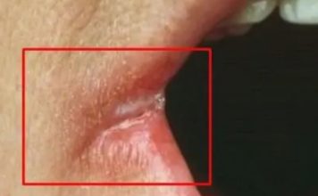 OPASNO PO ŽIVOT: Imate li neki od OVIH simptoma? Nagovještavaju nešto loše! OPASNO PO ŽIVOT: Imate li neki od OVIH simptoma? Nagovještavaju nešto loše! - featured image