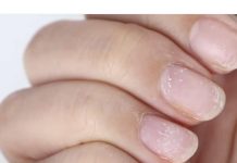 ZNAK ZA UZBUNU: Ako vidite OVO na vašim noktima idite doktoru odmah! ZNAK ZA UZBUNU: Ako vidite OVO na vašim noktima idite doktoru odmah! - featured image