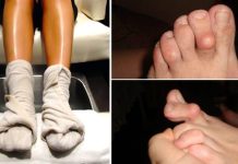 Mnogi se kunu u ovaj prirodni pristup – domaće rešenje koje ublažava tegobe artritisa! Mnogi se kunu u ovaj prirodni pristup – domaće rešenje koje ublažava tegobe artritisa! - featured image