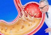 OVO JEDITE ZA VEČERU 3 DANA ZAREDOM: Nećete vjerovati šta će izaći iz vašeg stomaka OVO JEDITE ZA VEČERU 3 DANA ZAREDOM: Nećete vjerovati šta će izaći iz vašeg stomaka - featured image