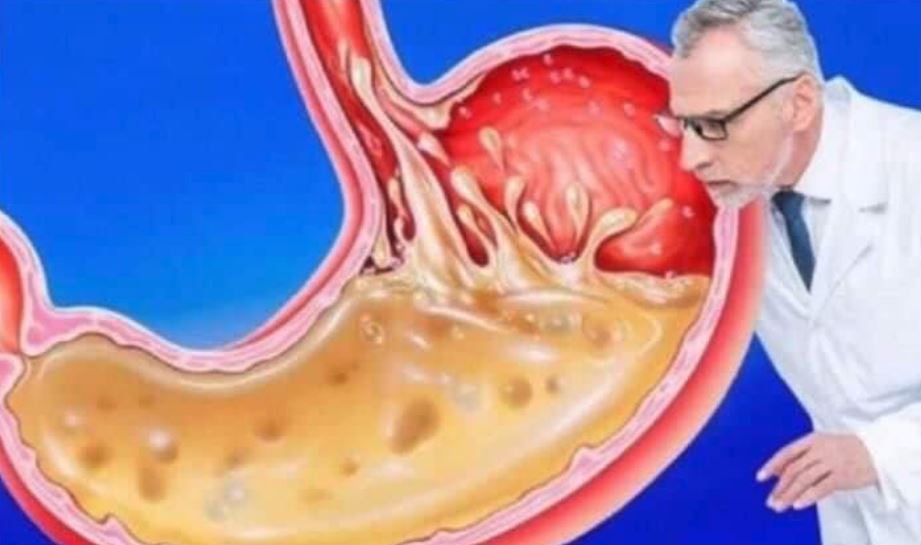 OVO JEDITE ZA VEČERU 3 DANA ZAREDOM: Nećete vjerovati šta će izaći iz vašeg stomaka - featured image OVO JEDITE ZA VEČERU 3 DANA ZAREDOM: Nećete vjerovati šta će izaći iz vašeg stomaka - featured image