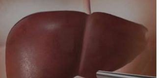 OVA HRANA UNIŠTAVA JETRU SKORO ISTO KOLIKO I ALKOHOL: 5 namirnica čiji unos morate ograničiti OVA HRANA UNIŠTAVA JETRU SKORO ISTO KOLIKO I ALKOHOL: 5 namirnica čiji unos morate ograničiti - featured image