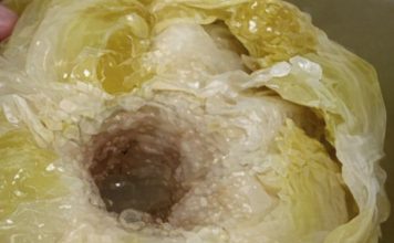 DOKTORI UPOZORILI: Ne jedite kiseli kupus ako bolujete od ovih bolesti DOKTORI UPOZORILI: Ne jedite kiseli kupus ako bolujete od ovih bolesti - featured image