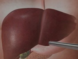 Jetra pod pritiskom: namirnice koje je opterećuju gotovo kao alkohol Jetra pod pritiskom: namirnice koje je opterećuju gotovo kao alkohol - featured image