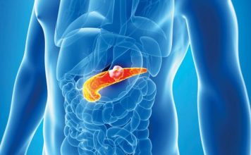 2 podmukle bolesti koje ugrožavaju zdravlje gušterače! Upoznajte ih prije nego što bude prekasno, SAVJETUJE D0KTOR I 0PISUJE SIMPT0ME 2 podmukle bolesti koje ugrožavaju zdravlje gušterače! Upoznajte ih prije nego što bude prekasno, SAVJETUJE D0KTOR I 0PISUJE SIMPT0ME - featured image