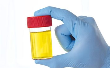 ZAŠTO IMATE JAK I NEPRIJATAN MIRIS URINA: Ovaj znak organizma ne smijete zanemariti! EVO NA ŠTA VAS UPOZORAVA ZAŠTO IMATE JAK I NEPRIJATAN MIRIS URINA: Ovaj znak organizma ne smijete zanemariti! EVO NA ŠTA VAS UPOZORAVA - featured image