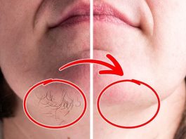 SVAKA ŽENA ZASLUŽUJE DA OVO ZNA: Prirodnim putem uklonite brkove i druge neželjene dlačice sa tijela zauvijek SVAKA ŽENA ZASLUŽUJE DA OVO ZNA: Prirodnim putem uklonite brkove i druge neželjene dlačice sa tijela zauvijek - featured image