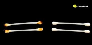 UŠNI VOSAK: šta vam govori o vašem zdravlju i kako pravilno njegovati uši UŠNI VOSAK: šta vam govori o vašem zdravlju i kako pravilno njegovati uši - featured image