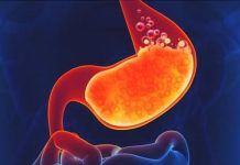 Ova hrana je najveći neprijatelj za želudac – Evo koje namirnice ne smijete jesti pred spavanje! Ova hrana je najveći neprijatelj za želudac – Evo koje namirnice ne smijete jesti pred spavanje! - featured image