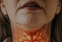 Ako imate problema sa štitnjačom, OVO vam je najveći neprijatelj: Ovu grešku pravi 8 od 10 ljudi sa štitnjačom Ako imate problema sa štitnjačom, OVO vam je najveći neprijatelj: Ovu grešku pravi 8 od 10 ljudi sa štitnjačom - featured image