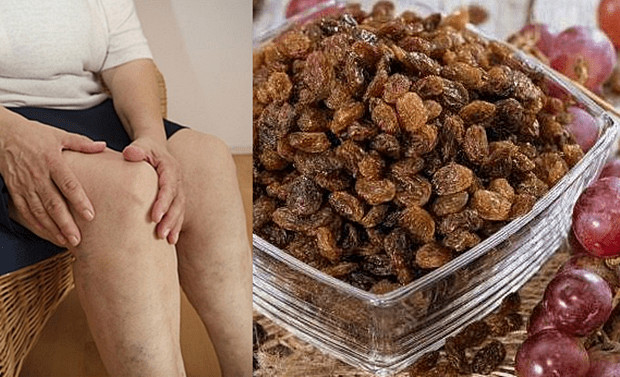 MNOGIMA JE POMOGLO – ISPROBAJTE: Za samo 1 mjesec, potpuno obnavlja kosti, tetive, ligamente, zglobove! - featured image MNOGIMA JE POMOGLO – ISPROBAJTE: Za samo 1 mjesec, potpuno obnavlja kosti, tetive, ligamente, zglobove! - featured image