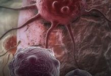 Dvije namirnice ubrzavaju starenje i podstiču rak: Izbjegavajte ih nakon 40. godine Dvije namirnice ubrzavaju starenje i podstiču rak: Izbjegavajte ih nakon 40. godine - featured image