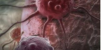 Dvije namirnice ubrzavaju starenje i podstiču rak: Izbjegavajte ih nakon 40. godine Dvije namirnice ubrzavaju starenje i podstiču rak: Izbjegavajte ih nakon 40. godine - featured image