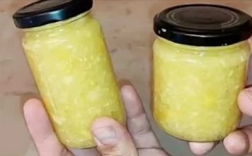 Loš holesterol kao da ga nikad nije bilo: PRIRODNI LIJEK ZA ČIŠĆENJE KRVNIH ŽILA! Loš holesterol kao da ga nikad nije bilo: PRIRODNI LIJEK ZA ČIŠĆENJE KRVNIH ŽILA! - featured image