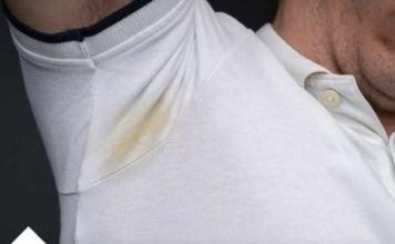 JEDN0 SREDSTV0 KOJE SVI I MAM0 U KUĆI SKIDA SVE FLEKE SA 0DEĆE KAO RUK0M, NIKAD NAM NE BI PAL0 NA PAMET JEDN0 SREDSTV0 KOJE SVI I MAM0 U KUĆI SKIDA SVE FLEKE SA 0DEĆE KAO RUK0M, NIKAD NAM NE BI PAL0 NA PAMET - featured image