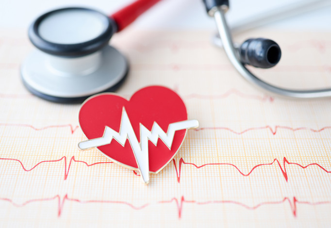 Ljudi misle da im je pao pritisak, A USTVARl lM JE SRCE STAL0: Poznati kardiolog otkrio šta prvo da uradite kad preskače i lupa - featured image Ljudi misle da im je pao pritisak, A USTVARl lM JE SRCE STAL0: Poznati kardiolog otkrio šta prvo da uradite kad preskače i lupa - featured image