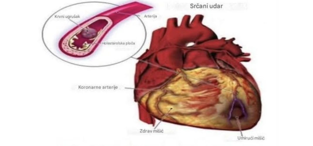 Evo kako pijenje čase vode na prazan želudac moze da djeluje na vaš organizam - featured image Evo kako pijenje čase vode na prazan želudac moze da djeluje na vaš organizam - featured image