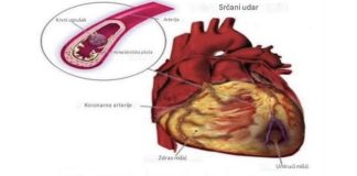 Evo kako pijenje čase vode na prazan želudac moze da djeluje na vaš organizam Evo kako pijenje čase vode na prazan želudac moze da djeluje na vaš organizam - featured image
