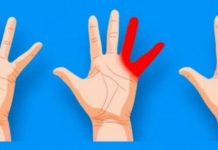 OBAVEZNO OBRATITE PAŽNJU: Ako vam trnu prsti, to može da znači nekoliko stvari, a ovo je uzrok OBAVEZNO OBRATITE PAŽNJU: Ako vam trnu prsti, to može da znači nekoliko stvari, a ovo je uzrok - featured image