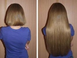 Stavite OVO u šampon kosa će da raste kao luda i biće bujna Stavite OVO u šampon kosa će da raste kao luda i biće bujna - featured image