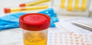 BOJA URINA otkriva mnoge ozbiljne bolesti, pa čak i one NAJTEŽE – Ovo je RAZLOG zbog kog vam je MOKRAĆA MUTNA BOJA URINA otkriva mnoge ozbiljne bolesti, pa čak i one NAJTEŽE – Ovo je RAZLOG zbog kog vam je MOKRAĆA MUTNA - featured image