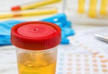 BOJA URINA otkriva mnoge ozbiljne bolesti, pa čak i one NAJTEŽE – Ovo je RAZLOG zbog kog vam je MOKRAĆA MUTNA BOJA URINA otkriva mnoge ozbiljne bolesti, pa čak i one NAJTEŽE – Ovo je RAZLOG zbog kog vam je MOKRAĆA MUTNA - featured image