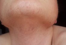 EVO ZAŠTO ŽENE IMAJU DLAKAVU BRADU! Ovo vam organizam govori! EVO ZAŠTO ŽENE IMAJU DLAKAVU BRADU! Ovo vam organizam govori! - featured image