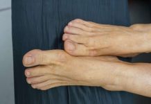 Visok holesterol možete prepoznati ako se zagledate u svoje noge: Ako primijetite ovo – imate ozbiljan problem Visok holesterol možete prepoznati ako se zagledate u svoje noge: Ako primijetite ovo – imate ozbiljan problem - featured image