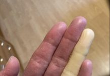 Ovo su posljedice spavanja sa… Ovo su posljedice spavanja sa… - featured image