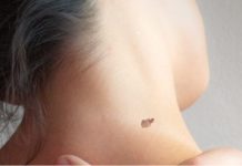 IMATE MLADEŽ IZ KOJEG RASTE DLAČICA – Evo šta to znači – Važno da znate IMATE MLADEŽ IZ KOJEG RASTE DLAČICA – Evo šta to znači – Važno da znate - featured image