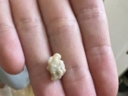 “Neočekivano i šokantno iskustvo: Ono što je izašlo iz mog grla će vas ostaviti bez riječi 😳” “Neočekivano i šokantno iskustvo: Ono što je izašlo iz mog grla će vas ostaviti bez riječi 😳” - featured image