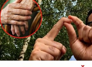 OBLOG KOJI IZVLAČI SAV BOL IZ TIJELA: Provjeren lijek za reumu, išijas, giht i artritis… OBLOG KOJI IZVLAČI SAV BOL IZ TIJELA: Provjeren lijek za reumu, išijas, giht i artritis… - featured image